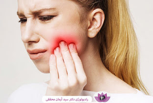 آبسه دندان چیست و چگونه با رادیوگرافی تشخیص داده می‌شود؟