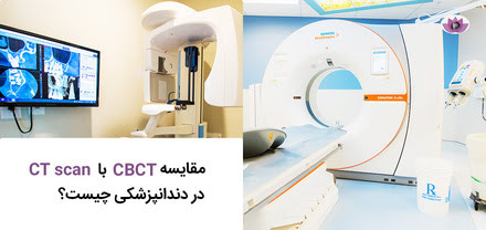 مقایسه CBCT و CT Scan در دندانپزشکی | دکتر آرمان محققی اهواز
