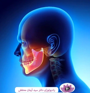 کیست فک چیست؟ علل، علائم، تشخیص و درمان
